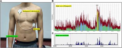 Concurrent validity of the combined HRV/ACC sensor and physical activity diary when monitoring physical activity in university students during free-living days